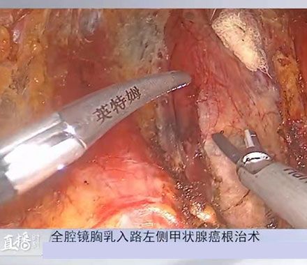 �����f(xi��)�h�t(y��)Ժ���g(sh��)ֱ��